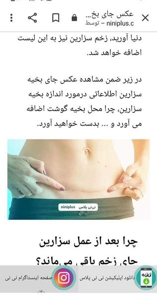 عکس دستگاه تناسلی بعد از زایمان طبیعی نی نی سایت