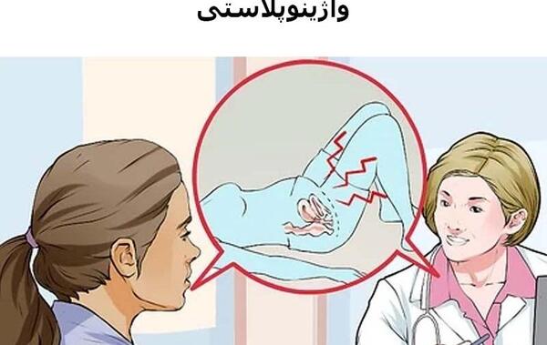 عکس دستگاه تناسلی بعد از زایمان طبیعی نی نی سایت