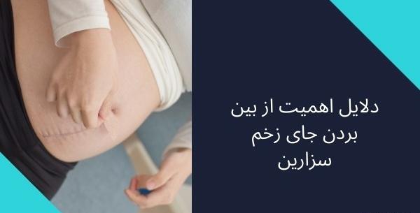 عکس بخیه واژن بعد از زایمان طبیعی نی نی سایت
