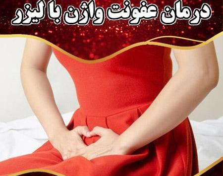 قارچی عکس ترشحات پنیری واژن نی نی سایت