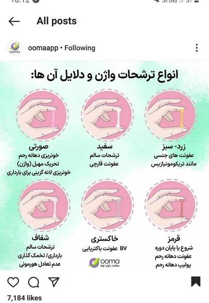 قارچی عکس ترشحات پنیری واژن نی نی سایت