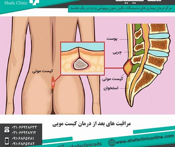 عکس مو برگشتی نی نی سایت