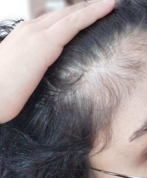 عکس کش مو نی نی سایت