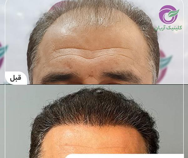 عکس جلوی موهاتون نی نی سایت