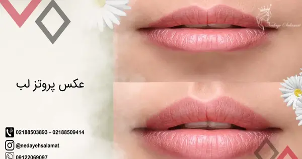 عکس لب قلوه ای نی نی سایت