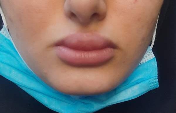 عکس لب قلوه ای نی نی سایت