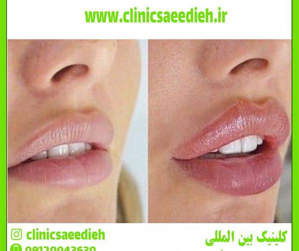 عکس لب قلوه ای نی نی سایت