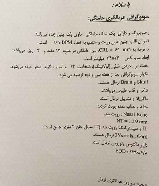 عکس سونو غربالگری اول نی نی سایت