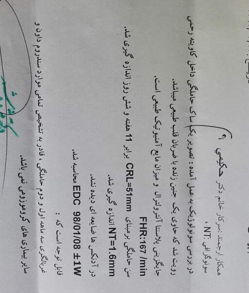 عکس سونو غربالگری اول نی نی سایت