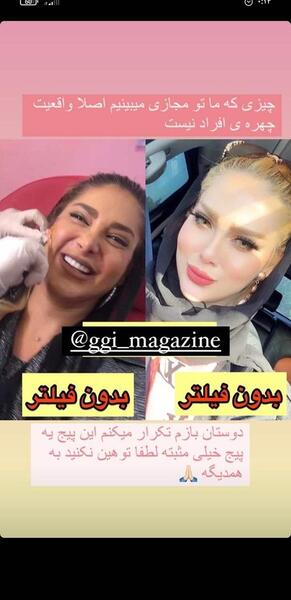 عکس بدون فیلتر نی نی سایت