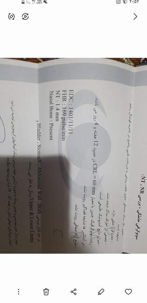 خانوما عکس جواب سونو غربالگری اول بزارید نی نی سایت