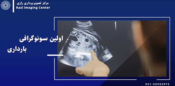 خانوما عکس جواب سونو غربالگری اول بزارید نی نی سایت