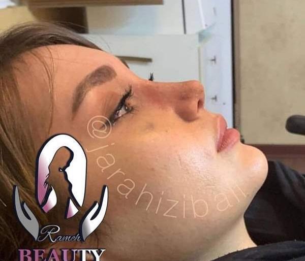 عکس عمل بینی طبیعی نی نی سایت