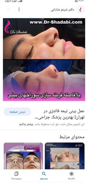 عکس عمل بینی طبیعی نی نی سایت