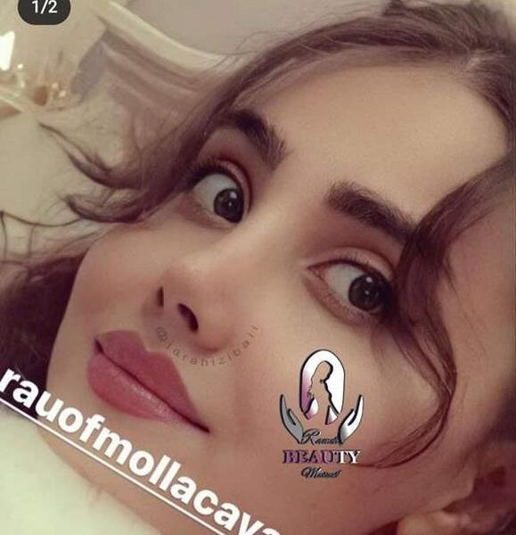 هزینه عکس عمل بینی نی نی سایت