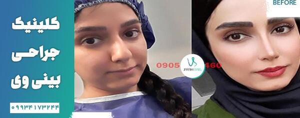 هزینه عکس عمل بینی نی نی سایت