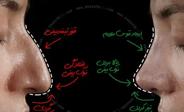 هزینه عکس عمل بینی نی نی سایت