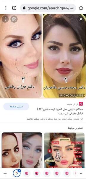 هزینه عکس عمل بینی نی نی سایت