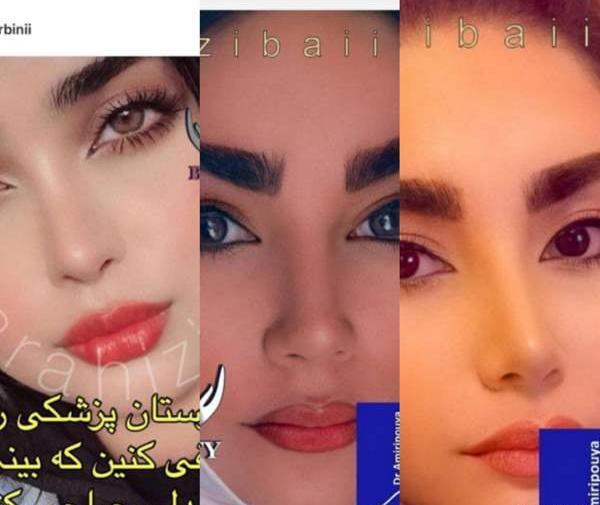 عکس قبل از عمل بینی نی نی سایت