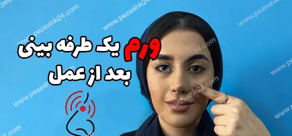 عکس بعد از عمل بینی نی نی سایت
