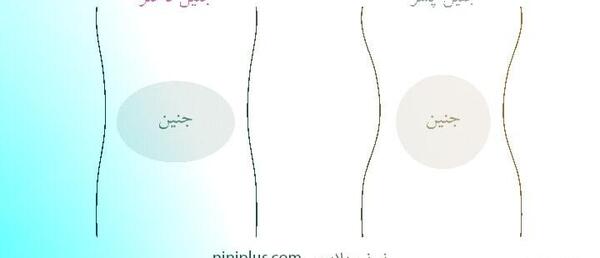 جنسيت جنين عکس شکمتون نی نی سایت