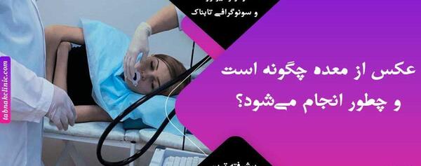 عکس رنگی شکم نی نی سایت