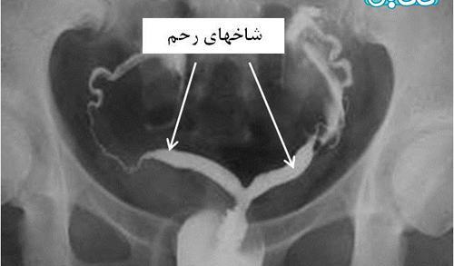 عکس رنگی شکم نی نی سایت