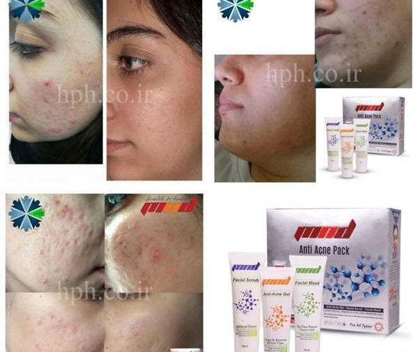 عکس فیشیال صورت نی نی سایت