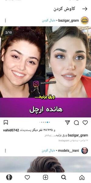 عکس فیشیال صورت نی نی سایت