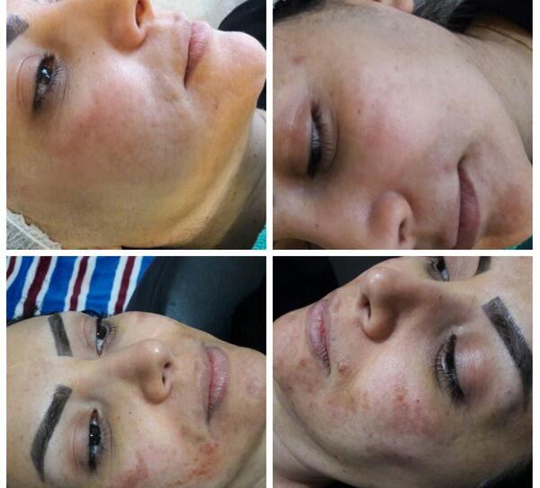 عکس فیشیال صورت نی نی سایت