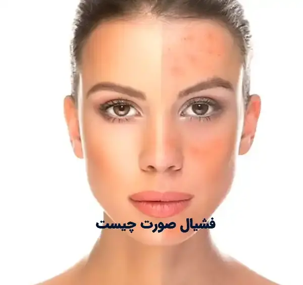 عکس فیشیال صورت نی نی سایت