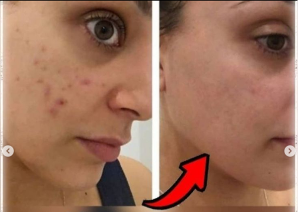 عکس فیشیال صورت نی نی سایت