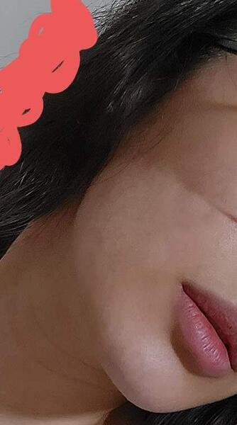 عکس فیشیال صورت نی نی سایت