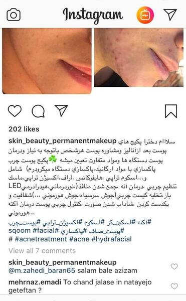 عکس فیشیال صورت نی نی سایت