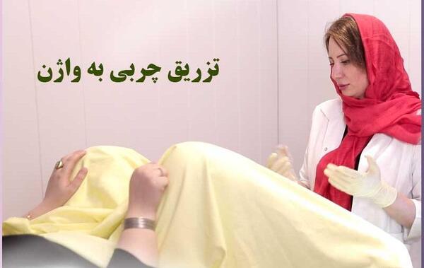 عکس تزریق چربی به صورت نی نی سایت