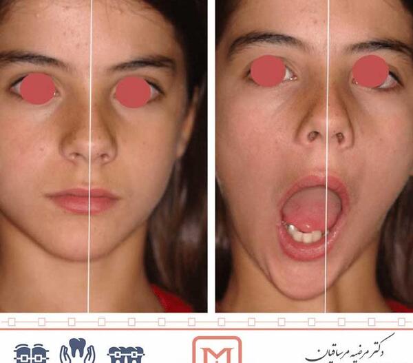 چرا تو عکس صورتم کج میشه نی نی سایت
