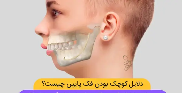 چرا تو عکس صورتم کج میشه نی نی سایت