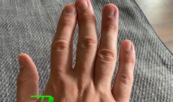 چرا تو عکس صورتم کج میشه نی نی سایت