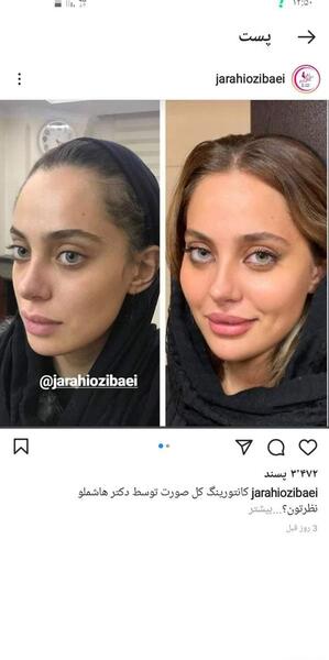 چرا تو عکس صورتم کج میشه نی نی سایت