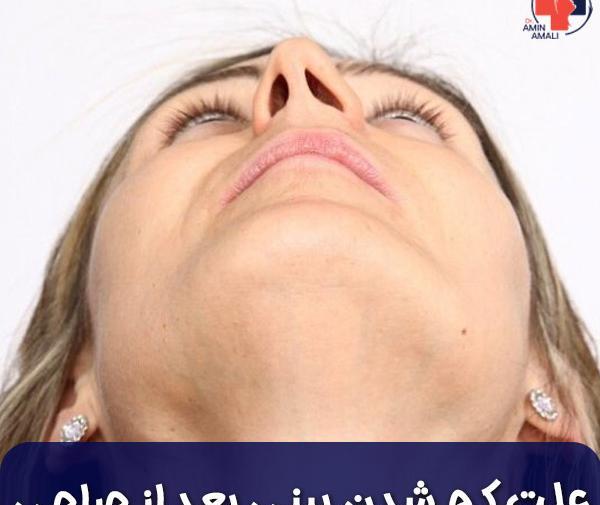 چرا تو عکس صورتم کج میشه نی نی سایت