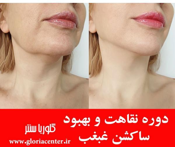 چرا تو عکس صورتم کج میشه نی نی سایت