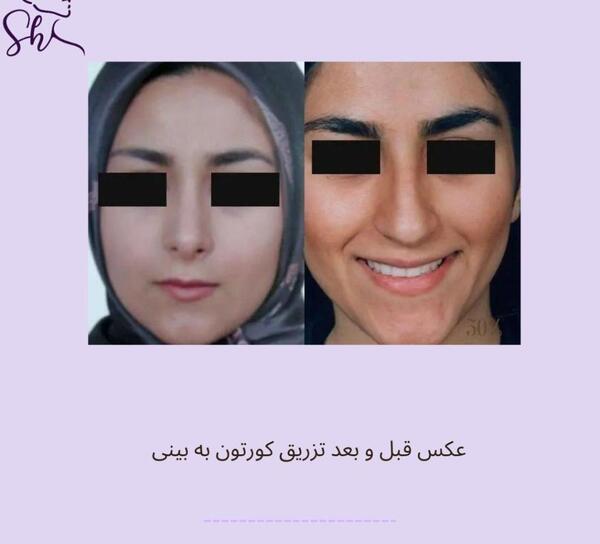 چرا تو عکس صورتم کجه نی نی سایت