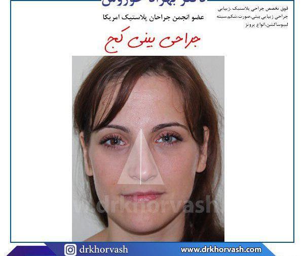 چرا تو عکس صورتم کجه نی نی سایت