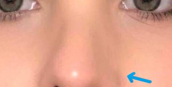 چرا تو عکس صورتم کجه نی نی سایت