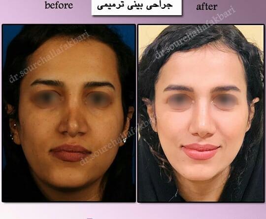 نامتقارن بودن صورت در عکس نی نی سایت
