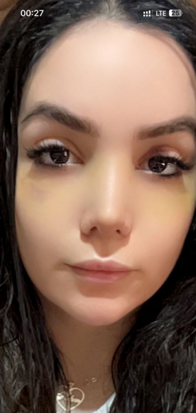 نامتقارن بودن صورت در عکس نی نی سایت