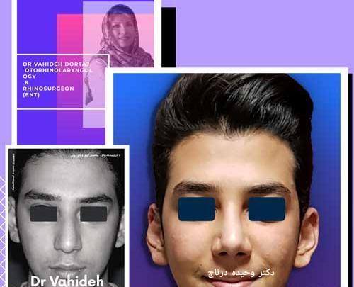 نامتقارن بودن صورت در عکس نی نی سایت