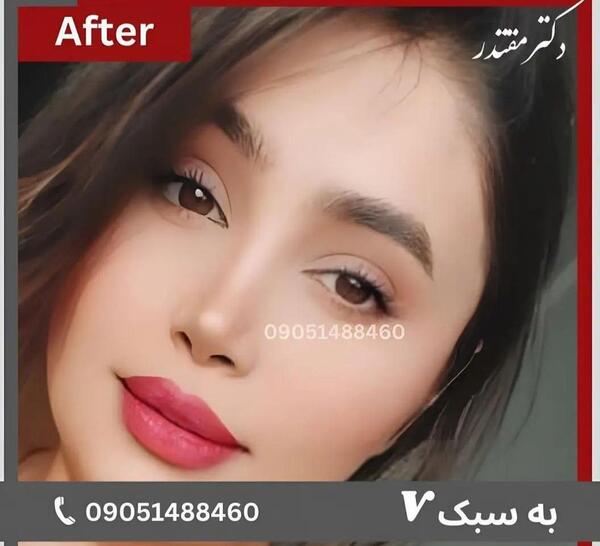 نامتقارن بودن صورت در عکس نی نی سایت