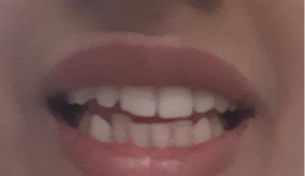 کج افتادن صورت در عکس نی نی سایت