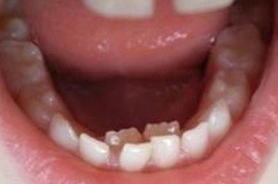 کج افتادن صورت در عکس نی نی سایت